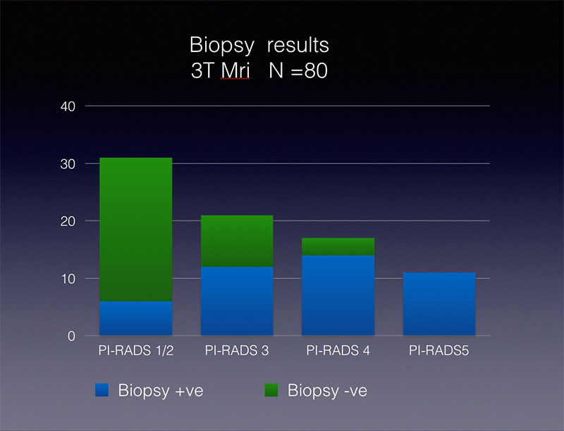 Biopsy results